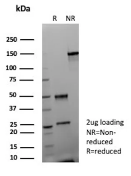 CR1 Antibody