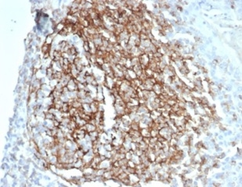 CR1 Antibody