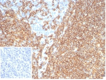 Recombinant CD20 / MS4A1 (B-Cell Marker) Antibody
