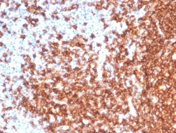 Recombinant CD20 / MS4A1 (B-Cell Marker) Antibody