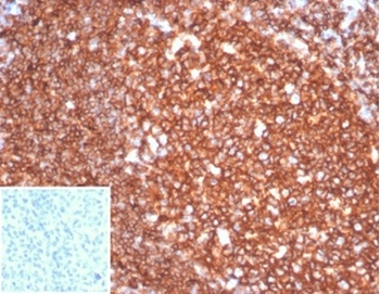 Recombinant CD20 / MS4A1 (B-Cell Marker) Antibody