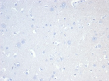 Recombinant CD20 / MS4A1 (B-Cell Marker) Antibody