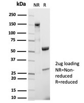 Recombinant CD20 / MS4A1 (B-Cell Marker) Antibody