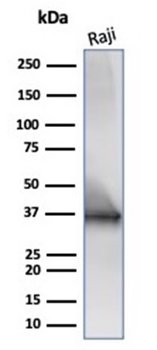Recombinant CD20 / MS4A1 (B-Cell Marker) Antibody