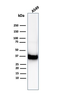 ANXA1 Antibody