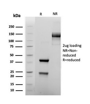 FOXP1 Antibody