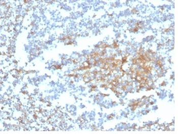 GC Antibody