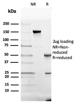 GC Antibody