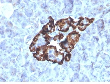 GC Antibody