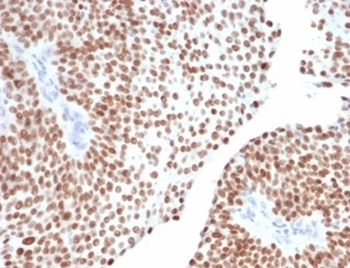 GATA3 Antibody