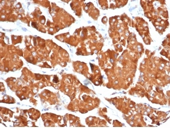 RHOBTB2 Antibody