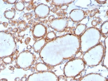 RHOBTB2 Antibody