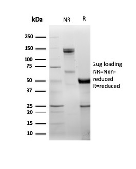 RHOBTB2 Antibody