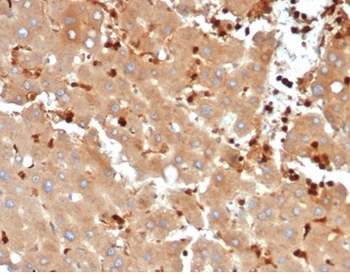 FABP5 Antibody