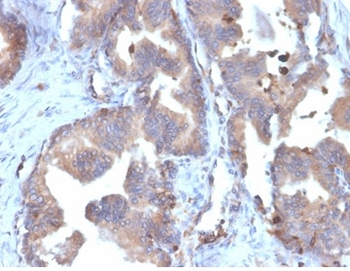 FABP5 Antibody