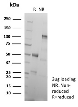 FABP5 Antibody