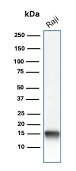 FABP5 Antibody