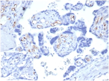 FABP4 Antibody