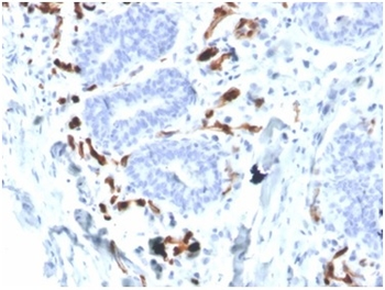 FABP4 Antibody