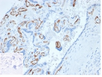 FABP4 Antibody