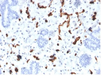 FABP4 Antibody