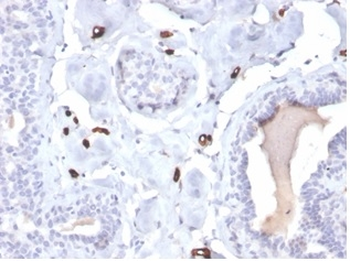 FABP4 Antibody