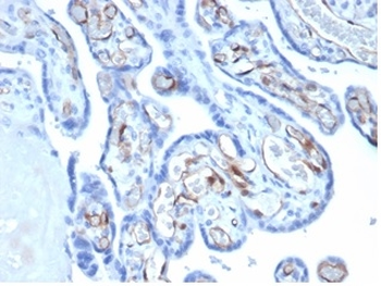 FABP4 Antibody