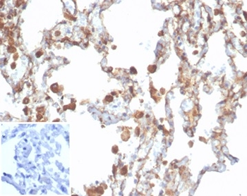 ALDH1A1 Antibody