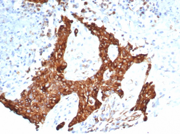 TUBB3 Antibody