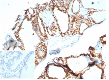 CDH16 Antibody