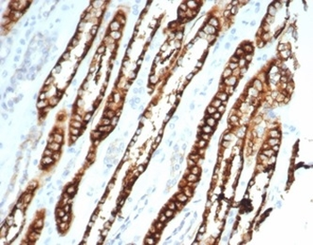 CDH16 Antibody
