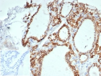 CDH16 Antibody