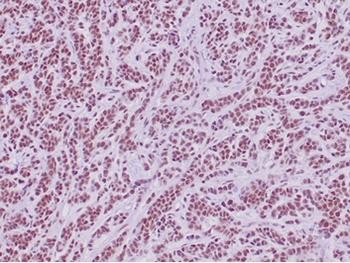 SMARCB1 Antibody