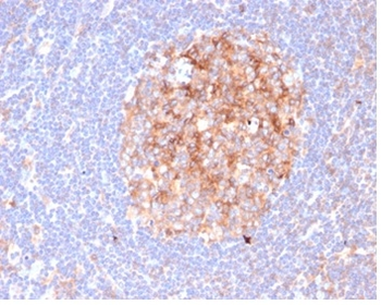 Recombinant CD86 (Dendritic Cells Maturation Marker) Antibody