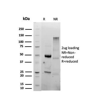 Recombinant CD86 (Dendritic Cells Maturation Marker) Antibody