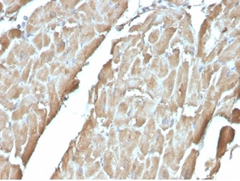 FABP3 Antibody
