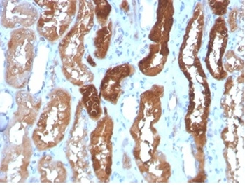 FABP3 Antibody