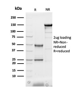 FABP3 Antibody