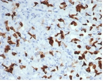 MSH6 Antibody