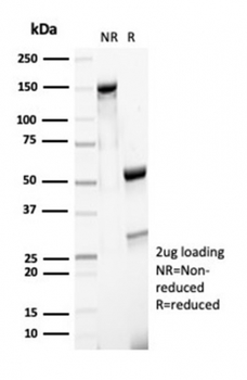 MSH6 Antibody