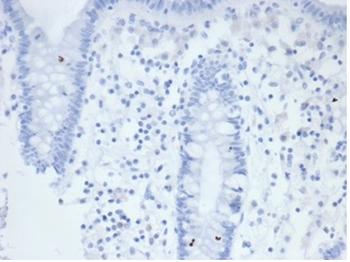 ALPP Antibody
