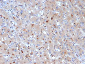 SERPINA3 Antibody