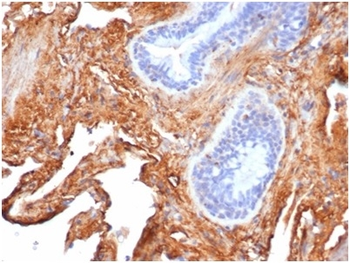 Fn1 Antibody