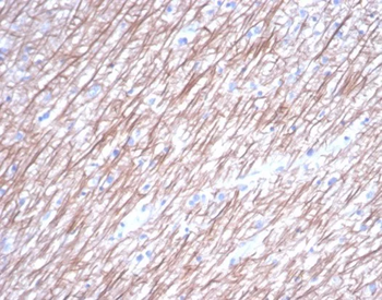 TUBB3 Antibody