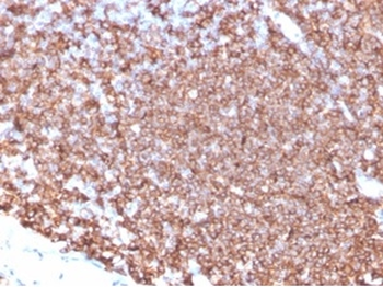 CD20 / MS4A1 (B-Cell Marker) Antibody