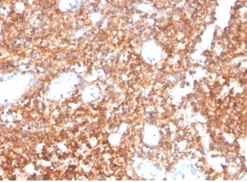 CD20 / MS4A1 (B-Cell Marker) Antibody