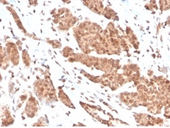 NME1 Antibody