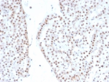 NR5A1 Antibody
