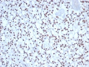 NCL Antibody