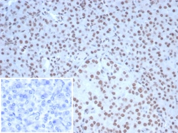 NCL Antibody